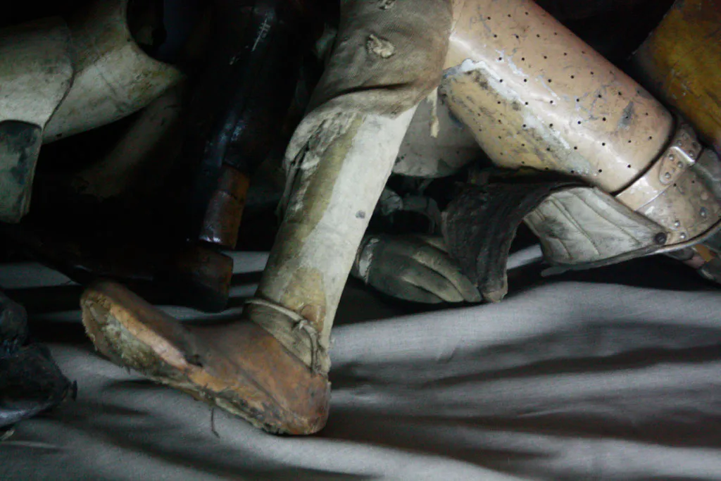 <p>Fractura de femur | fotografía digital</p>
